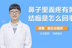 鼻子结痂怎么办速效办法